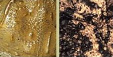 skin1